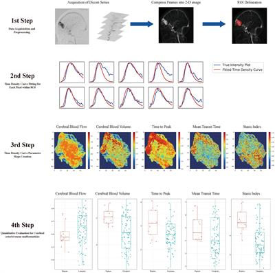 Quantitative evaluation of the subsequent hemorrhage with arteriography-derived hemodynamic features in patients with untreated cerebral arteriovenous malformation